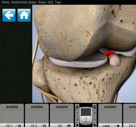 Chattanooga Intelect NEO Therapy System - Image 8